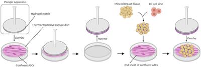 Quantifying Breast Cancer-Driven Fiber Alignment and Collagen Deposition in Primary Human Breast Tissue